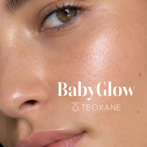 babyglow teoxane